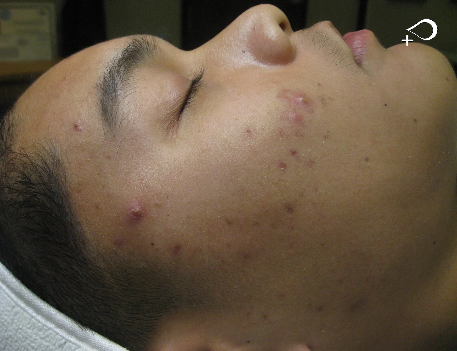 Jason Before_horizontal